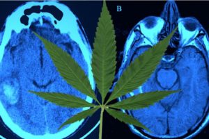 Efekty cannabis na mózg, KonopiaLeczy.com